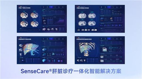 商湯醫(yī)療獲肝臟CT輔助診斷NMPA三類證，軟硬件零售賦能肝臟診療一體化新格局